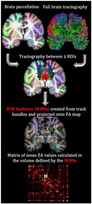 Chronic anemia: The effects on the connectivity of white matter